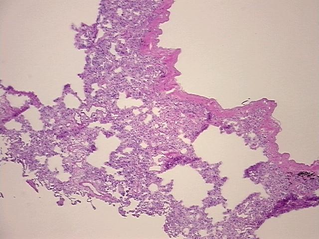 4x Image