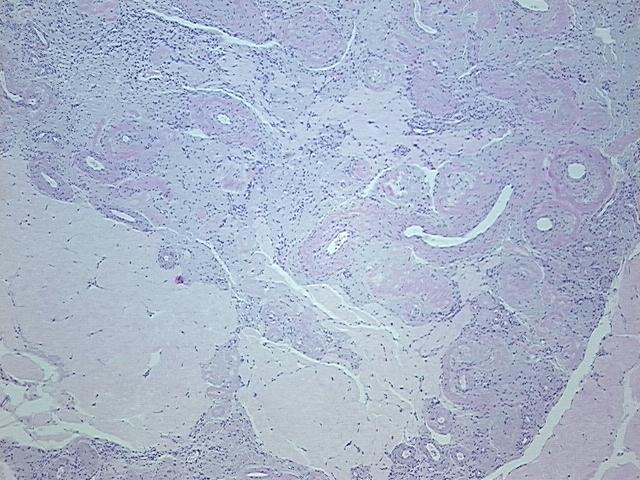 4x Image