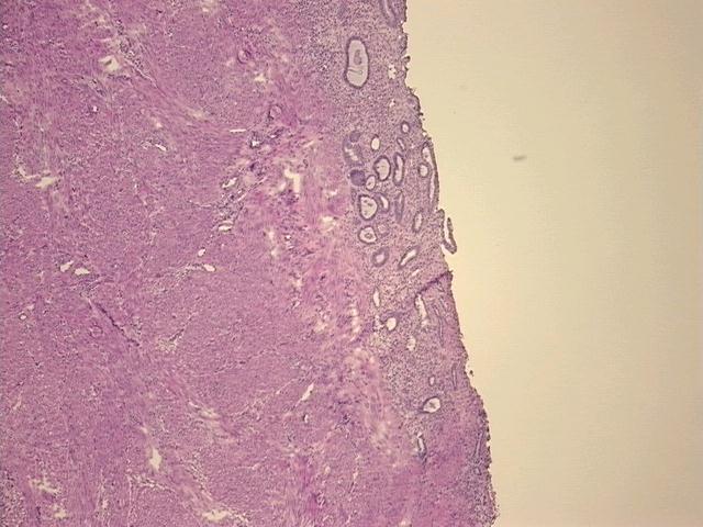 4x Image