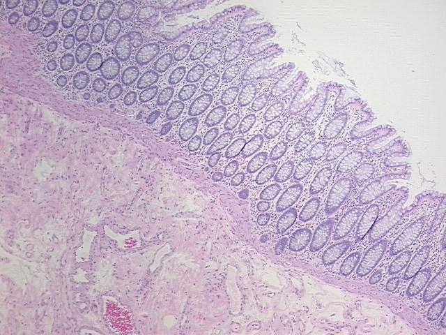 4x Image