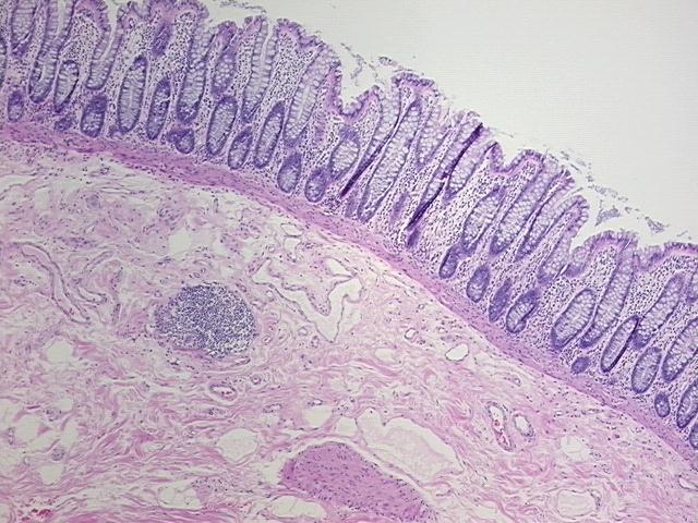 4x Image