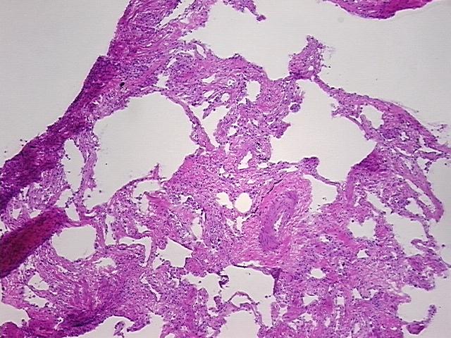 4x Image