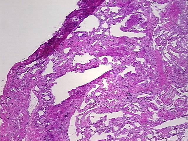 4x Image