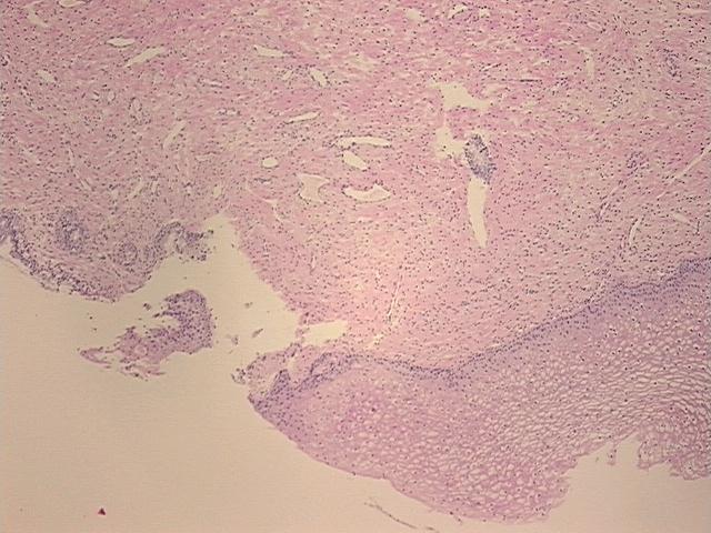 4x Image