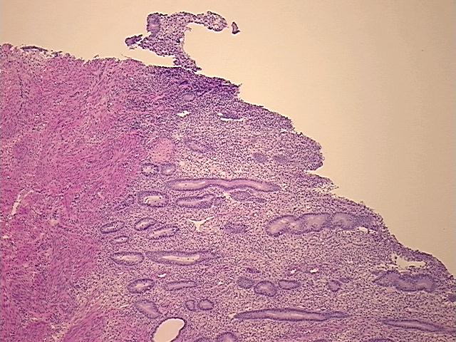 4x Image