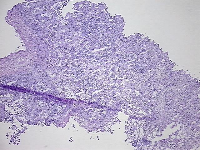 4x Image
