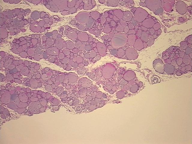 4x Image