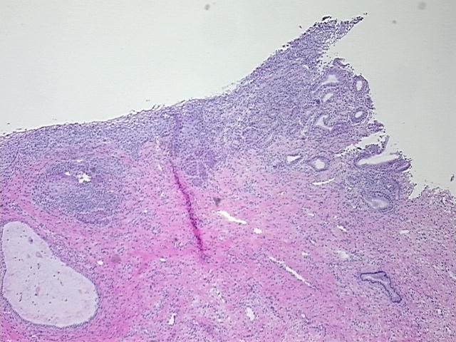4x Image