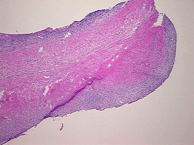 4x Image