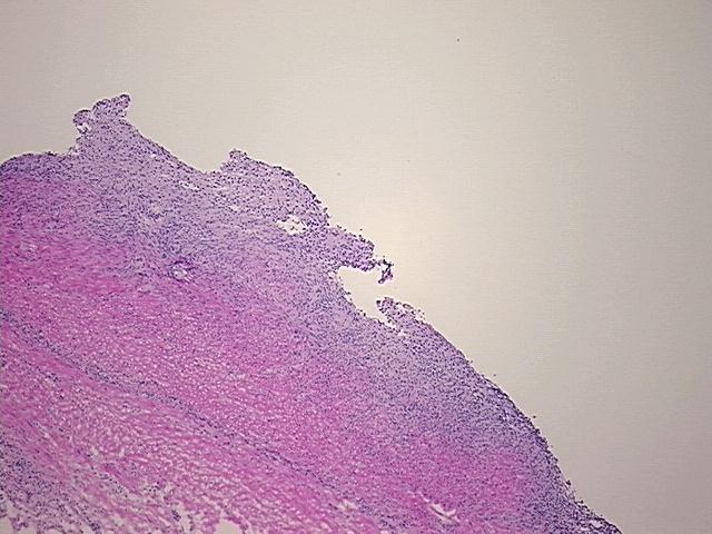 4x Image