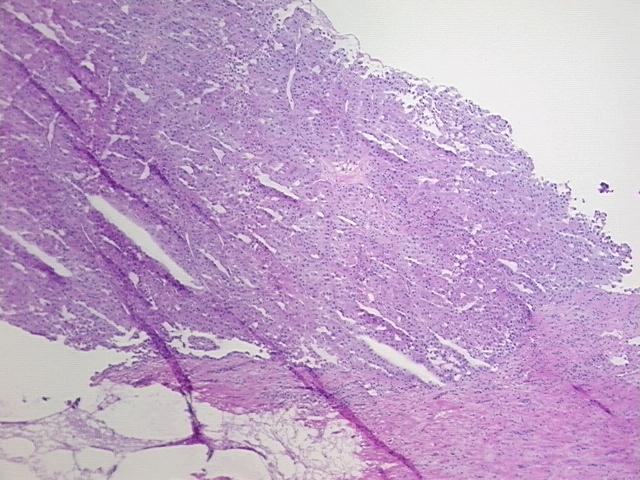 4x Image