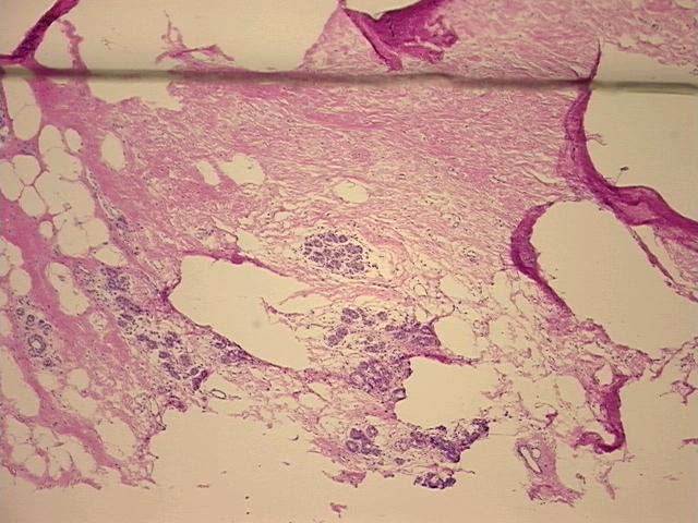 4x Image
