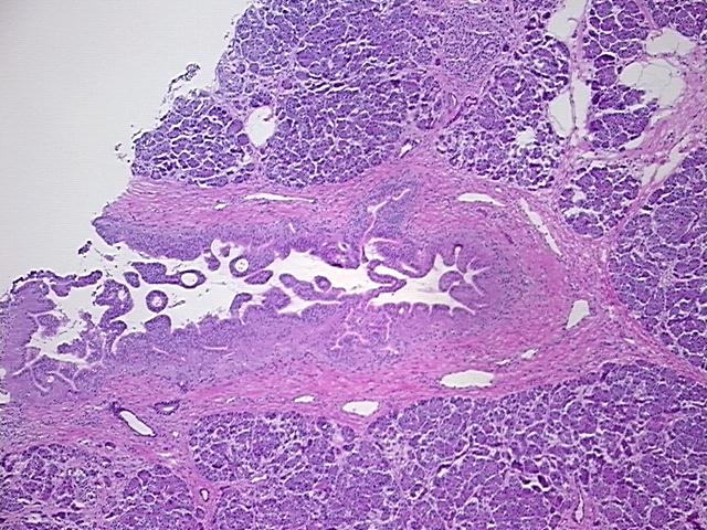 4x Image