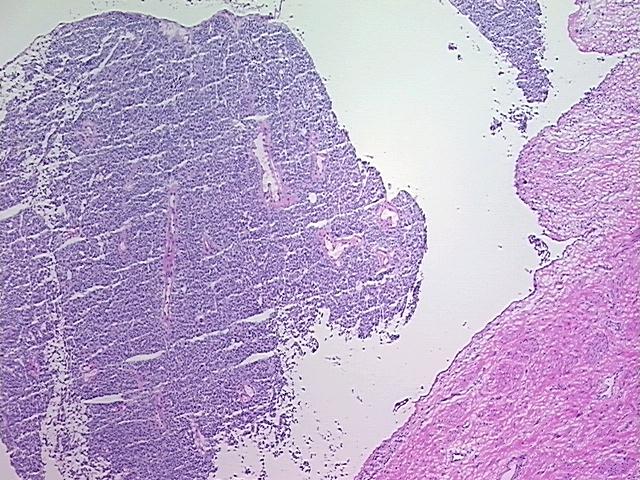 4x Image