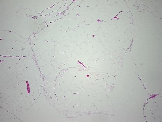 4x Image