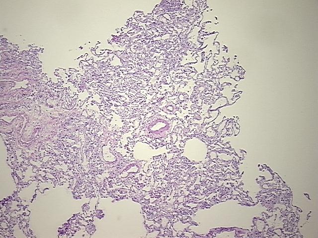 4x Image