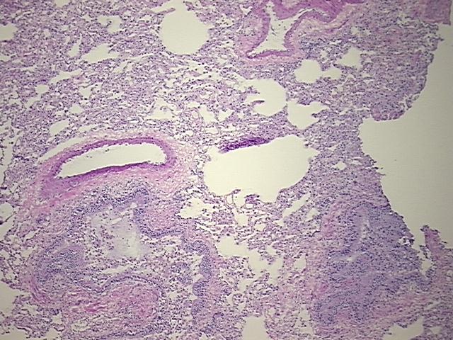 4x Image