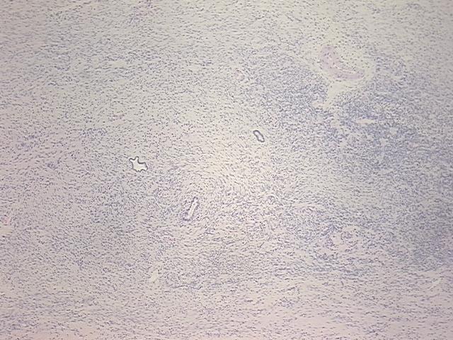 4x Image