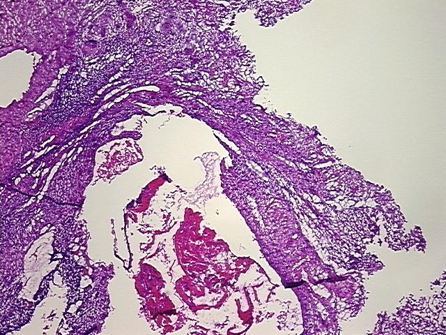 4x Image