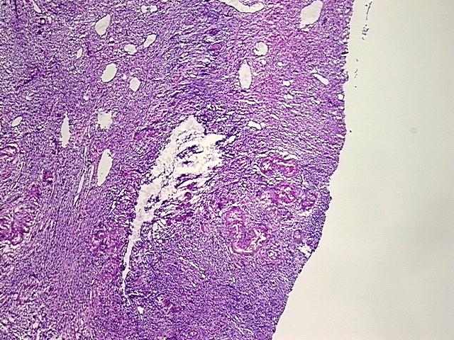 4x Image