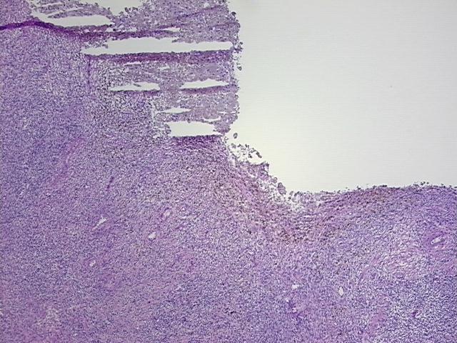 4x Image