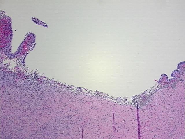 4x Image