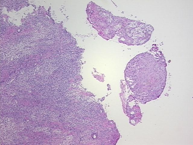 4x Image