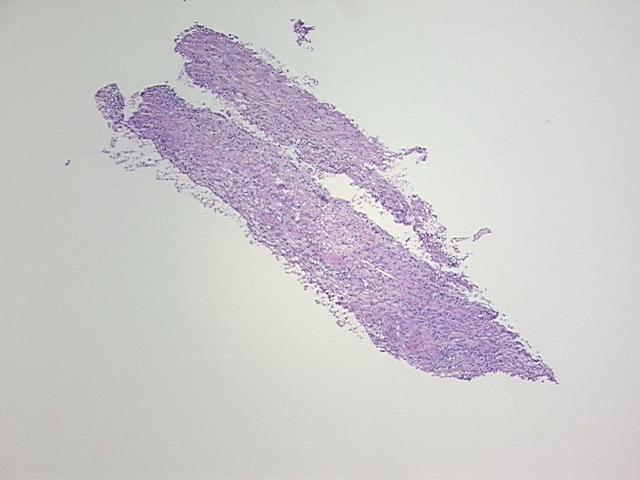 4x Image