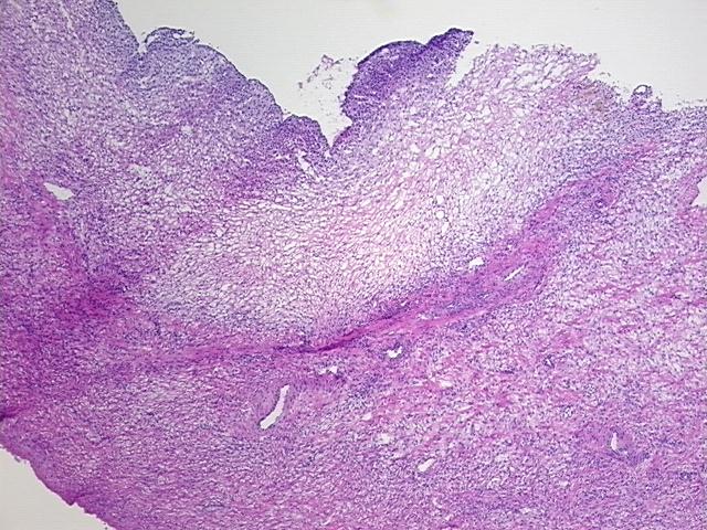 4x Image