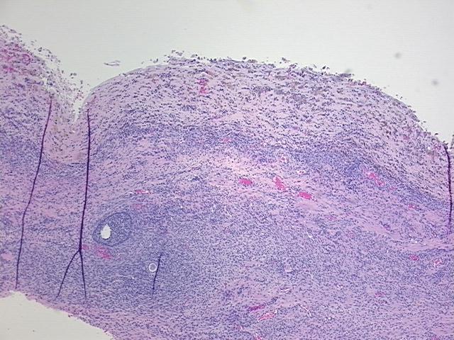 4x Image