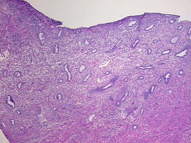 4x Image