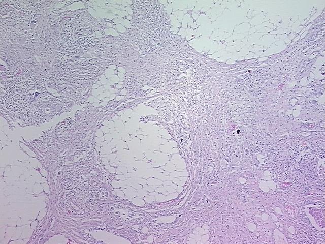 4x Image