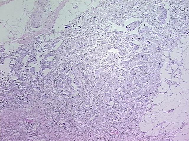 4x Image