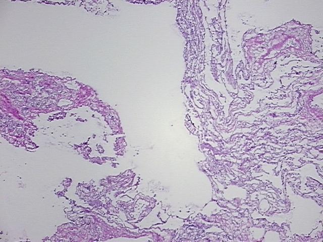 4x Image