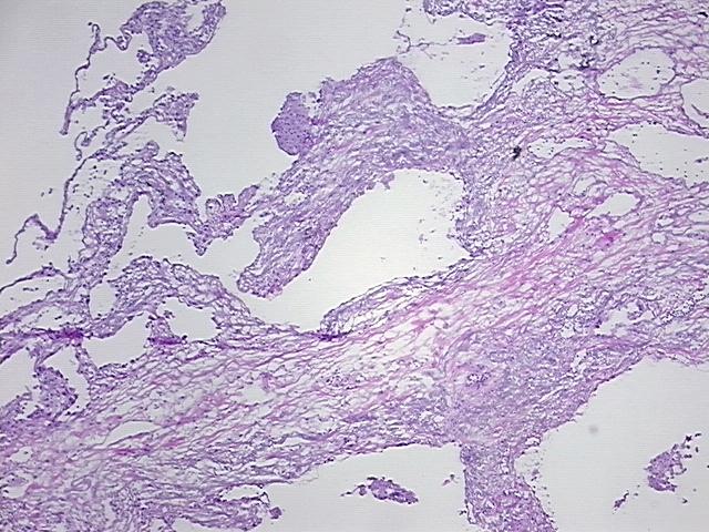 4x Image