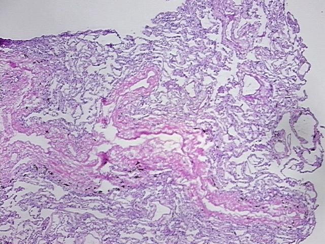 4x Image