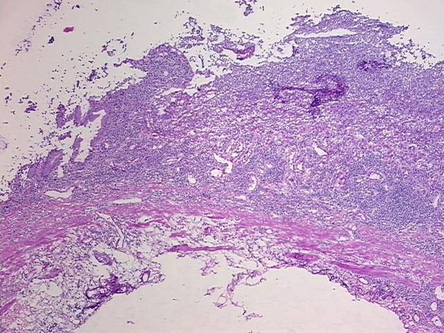 4x Image