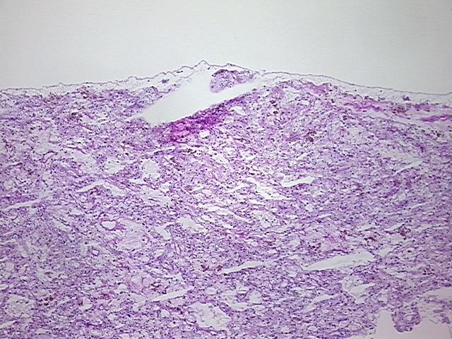4x Image