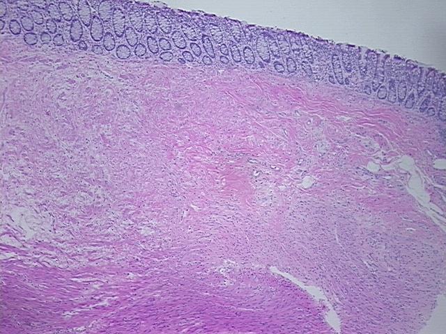 4x Image