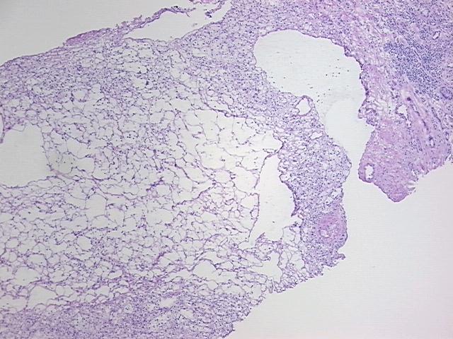 4x Image