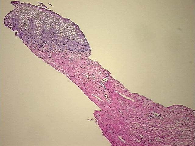 4x Image
