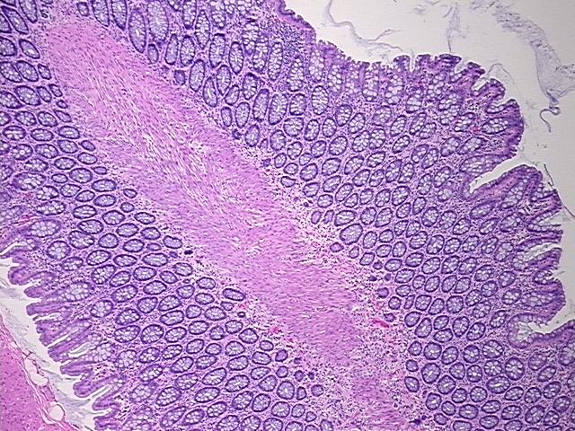 4x Image