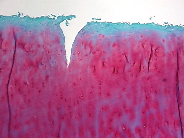 4x Image