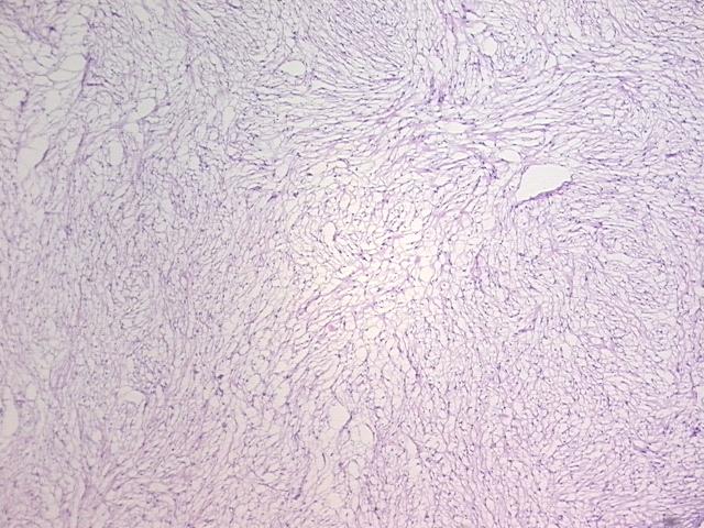 4x Image