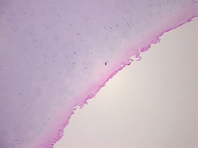 4x Image