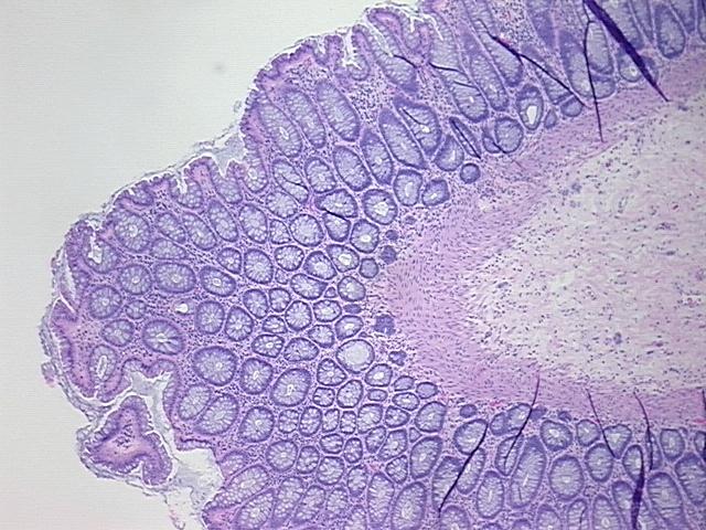 4x Image