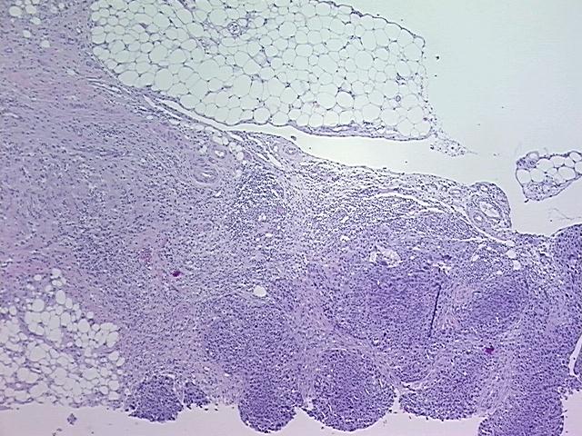 4x Image
