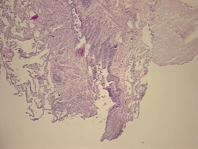 4x Image