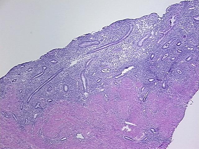 4x Image