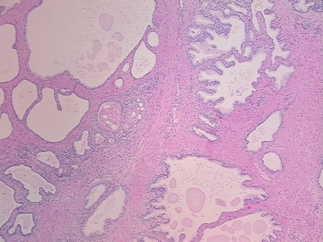 4x Image